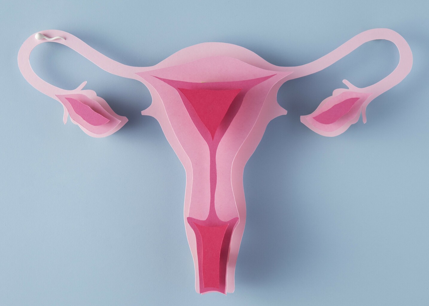 Sterilizace ženy