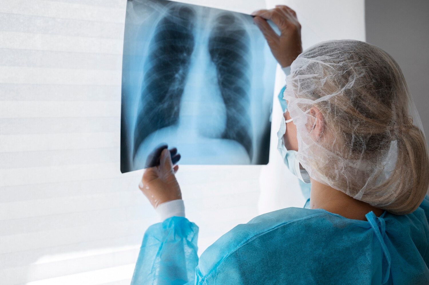 Pneumologie (Plicní lékařství)
