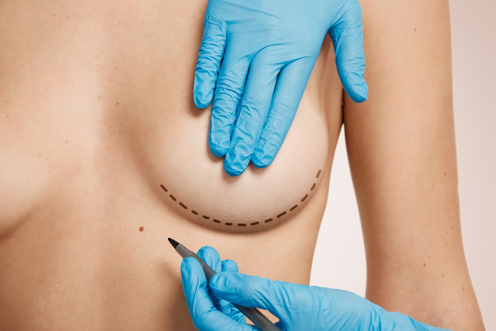 Zvětšení prsou implantáty